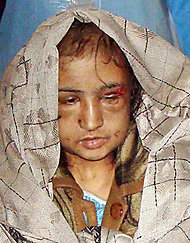 3 In-Laws of Afghan Girl, 15, Are Held in Her Torture